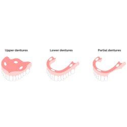 Proteselim IsoDent Adhesive Creme