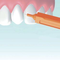 Spaltebrster Premium Mara Expert 0,45 mm ISO 1 ORANSJE