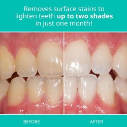 Tandblegning Tandpasta Opalescence Cool Mint 20 ml.