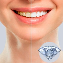 Tannbleking Tannkrem DR. WILD Emoform Diamond Fluoride 75ml