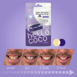 Zahnaufhellungsstreifen HELLO COCO Color Corrector Whitening Strips PAP  7 Behandlungen