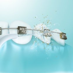 Mondstukken Voor Panasonic Monddouche Standaard Jet Nozzle 2 stuks