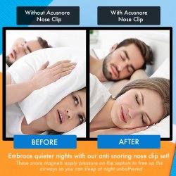 N�seklemme The Original ACUSNORE Anti-Snore Magnetic Nose Clip