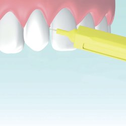 Gapborstar 14 st. Mara Expert Premium 0,70 mm ISO 4 GUL