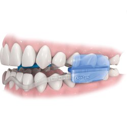 DenTek Bideskinne Comfort-Fit Dental Mouth Guard