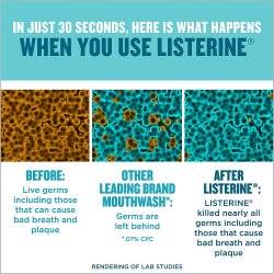 Listerine 750 ml. Cool Mint Mundskyl