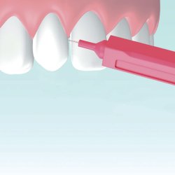 Mellemrumsbrster 14 stk. Mara Expert Premium 0.50 mm ISO 2 RD