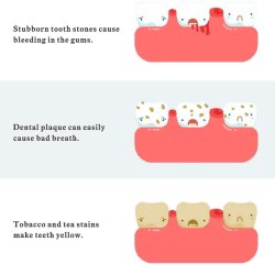 Elektrischer Zahnreiniger mit LED - NEUES MODELL - Entfernen Sie Plaque und Zahnstein zu Hause