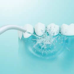 Mondstukken Voor Panasonic Monddouche Standaard Jet Nozzle 2 stuks