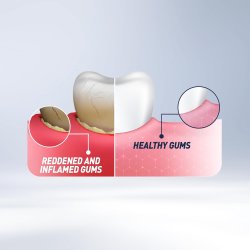 Parodentose Hydroxyapatit Tandpasta Gel BIOREPAIR Plus Parodontgel 75 ml