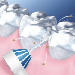 Oral-B Mundusch Microjet Power 4 Hydropulseur inklusive 8 st. Munstycken