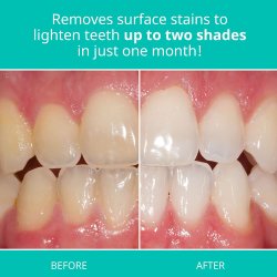 Tandblekning Tandkrm OPALESCENCE Sensitivity Relief 28g