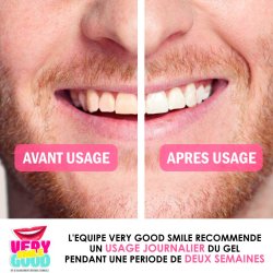 Tandblegningsst Very Good Smile