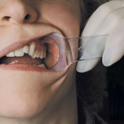 Kinntrekk Barn Mirahold Kinntrekk Hager Werken