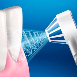 Oral-B Mundusch Microjet Power 4 Hydropulseur inklusive 8 st. Munstycken