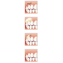 Periodontal dressing Reso-Pac Hager Werken 25g