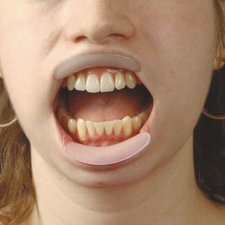 Munnpner Barn Spandex Mini Chins Werken