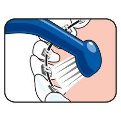 TePe Mono Tannbrste Universal Care Implant