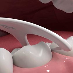 DenTek Comfort Clean Floss Back Teeth Picks Tanntrdholdere