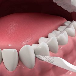 DenTek Comfort Clean Floss Back Teeth Picks Tanntrdholdere