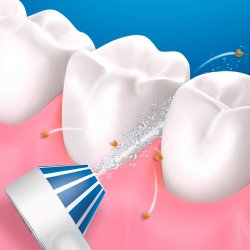 Oral-B Trdls Mundskyller AquaCare 4