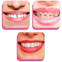 Piksters Gap borstar 10 st. 0.45 ISO 2 VIT