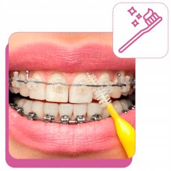 Piksters Gap borstar 10 st. 0.45 ISO 2 VIT