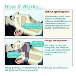 Anti-Snorkestrop - Stop Snorken - Snorkerem