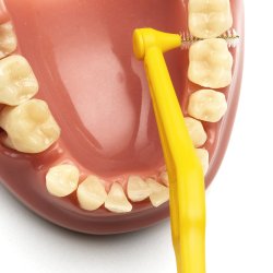 25 st TePe Angle Gap borstar GUL ISO 4 - 0,7 mm.