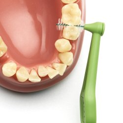 25 st. TePe Angle Gap borstar GRN ISO 5 - 0,8 mm.