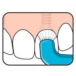 TePe Compact Tuft Mono Zahnbrste